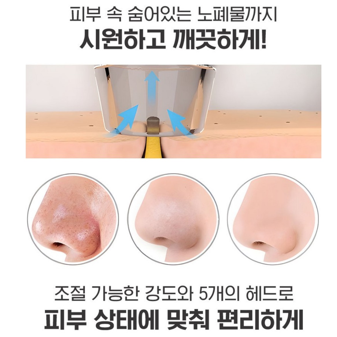피지 제거 압출기 뽀루지 피지 짜는 기계 블랙 헤드 압출 - 상세 이미지 3