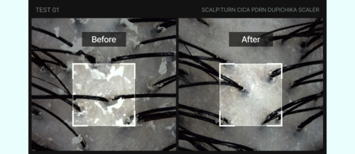 LILYEVE Scalpturn Cica PDRN Scalp Scaler - description 19