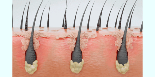 LILYEVE Scalpturn Cica PDRN Scalp Scaler - description 15
