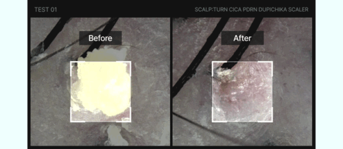 LILYEVE Scalpturn Cica PDRN Scalp Scaler - description 17