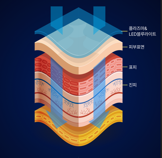 페디젠 문제성 발 관리기 플리즈마 LED블루라이트 - 상세 이미지 5