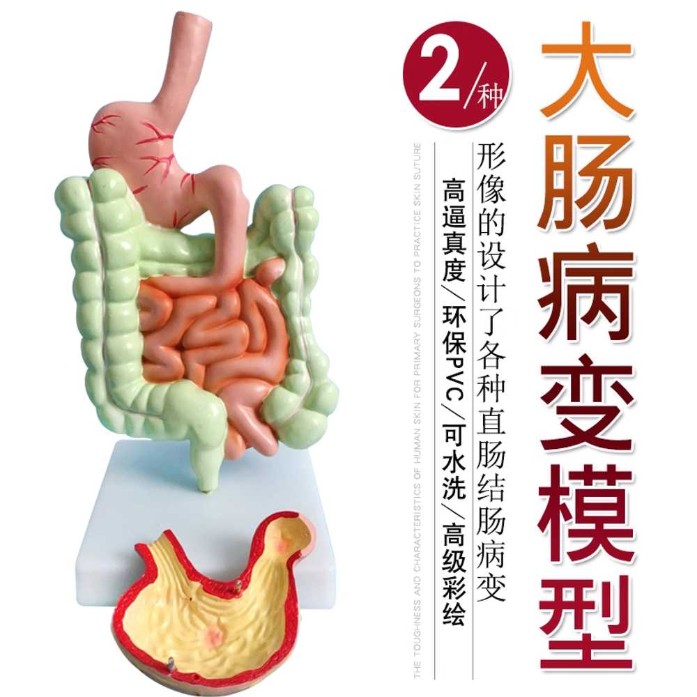 소화계 모형 장기 식도 대장 과학실 신장 해부학 학교 대장 - 상세 이미지 3