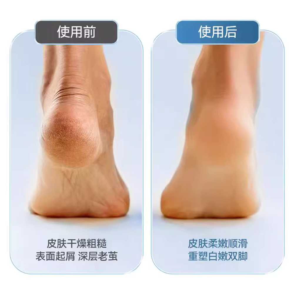 각질 제거기 발 뒤꿈치 관리 양면 손 드릴 굳은살 단일상품 - 상세 이미지 2