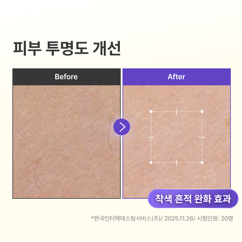 바렌 비타캡슐 나이아신아마이드 미백 바디로션 300g+8ml 2개 (팔꿈치 겨드랑이 착색크림 톤업 주름개선) - 상세 이미지 3
