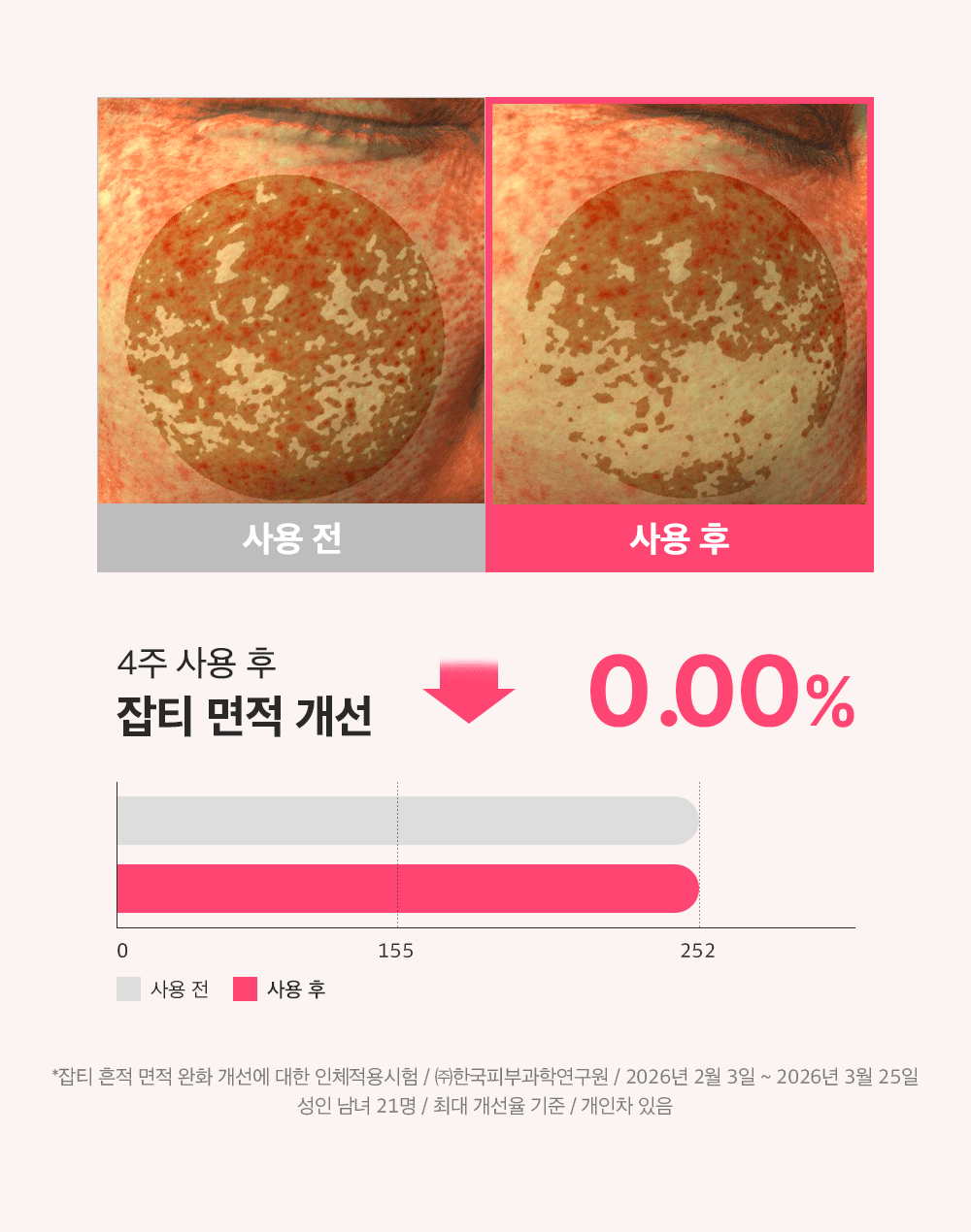 sungboon editor PDRN concentrated ampoule