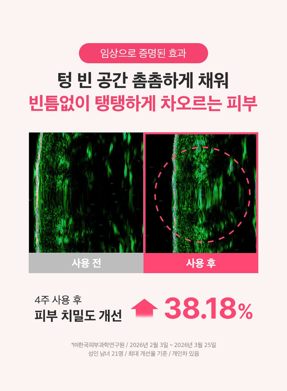 sungboon editor PDRN concentrated ampoule