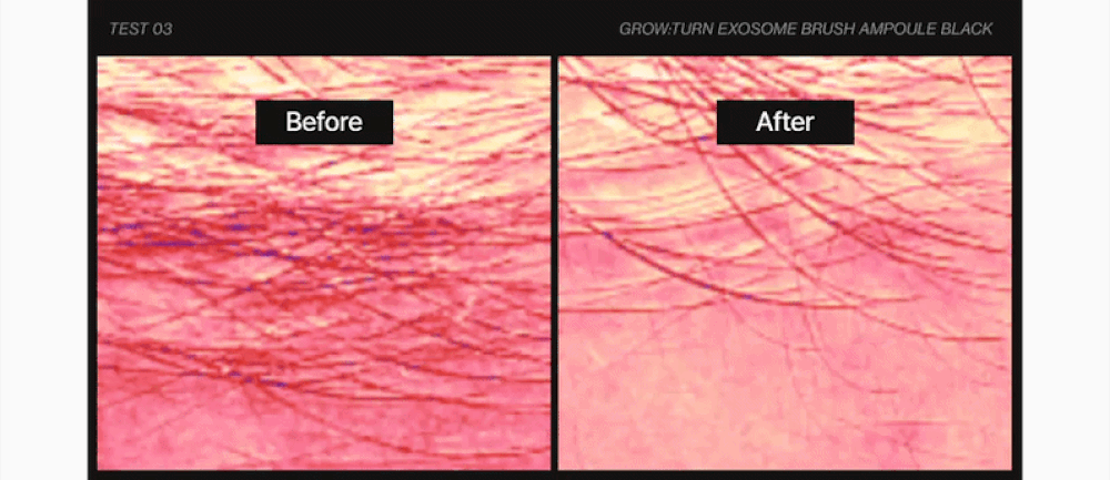 LILYEVE Growturn Exosome Brush Black Ampoule - description 34