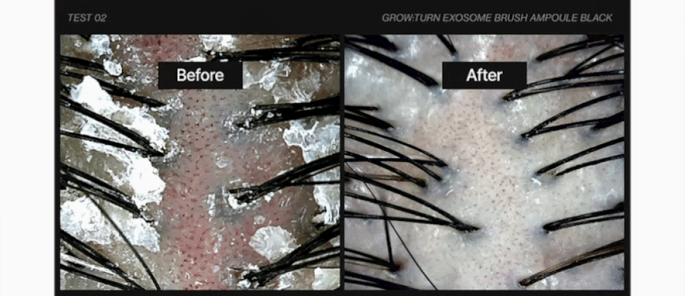 LILYEVE Growturn Exosome Brush Black Ampoule - description 31