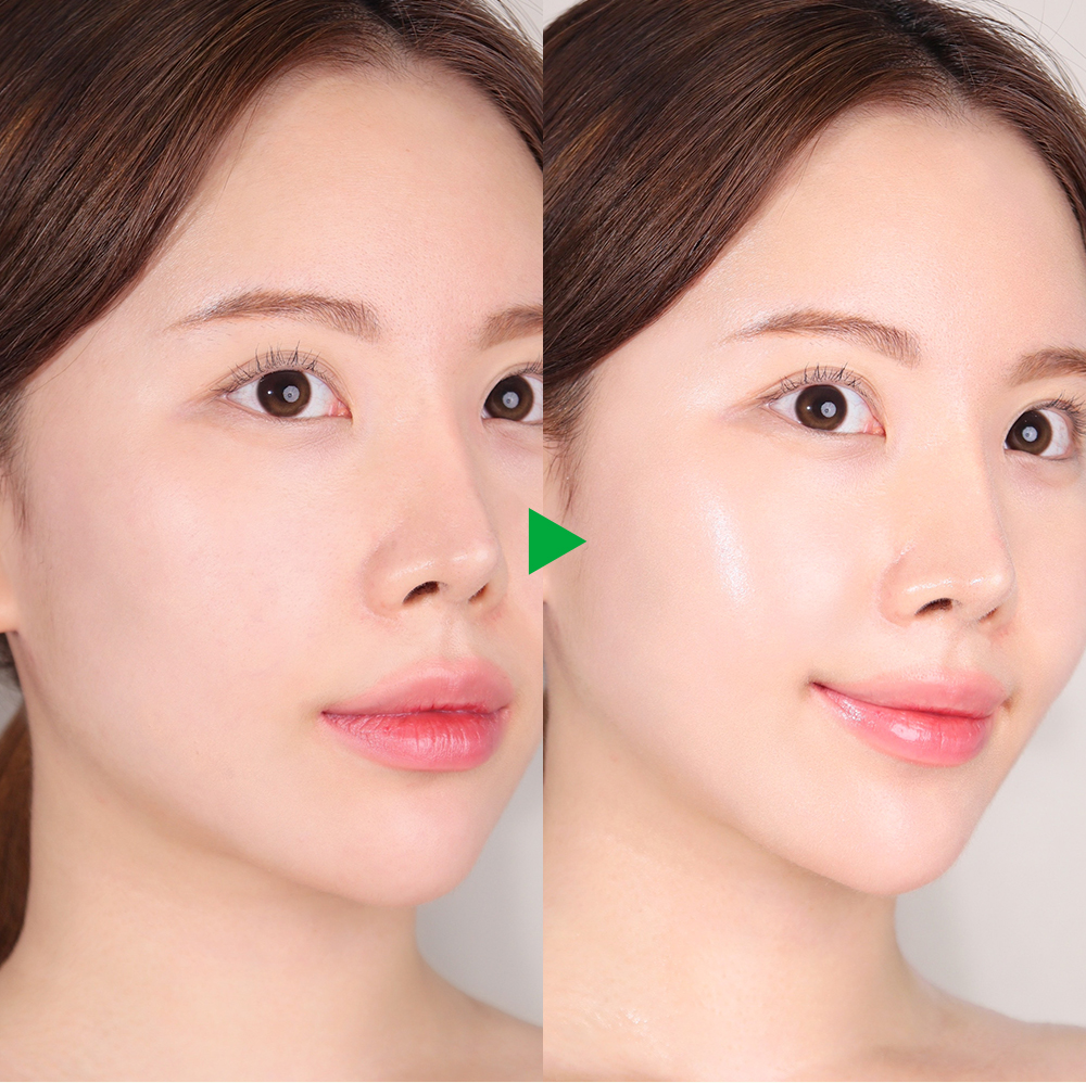 sungboon editor green tomato face mist