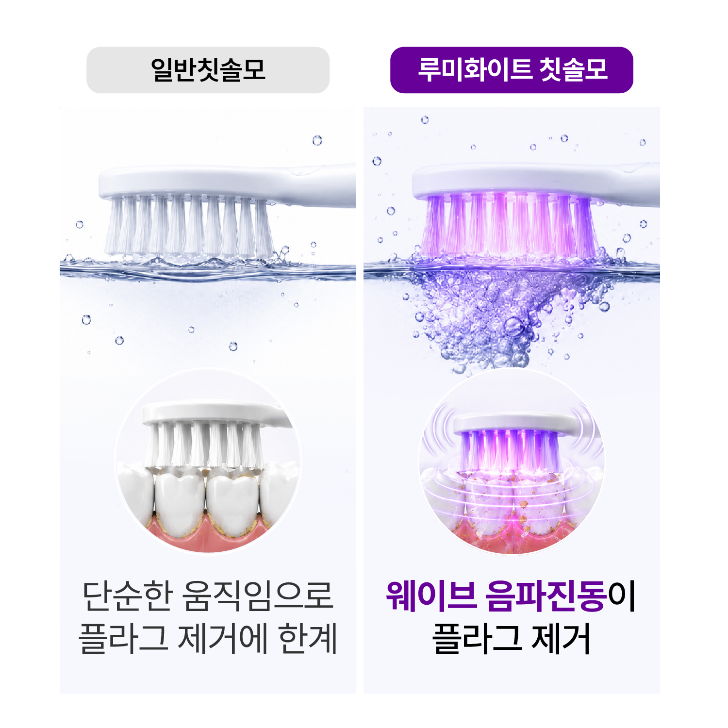 실제 치과 미백 시스템 채택 / 구강탄탄 루미화이트 미백 전동칫솔 특허 보라색 LED 광섬유 칫솔모 잇몸케어 스케일링 이미지 6