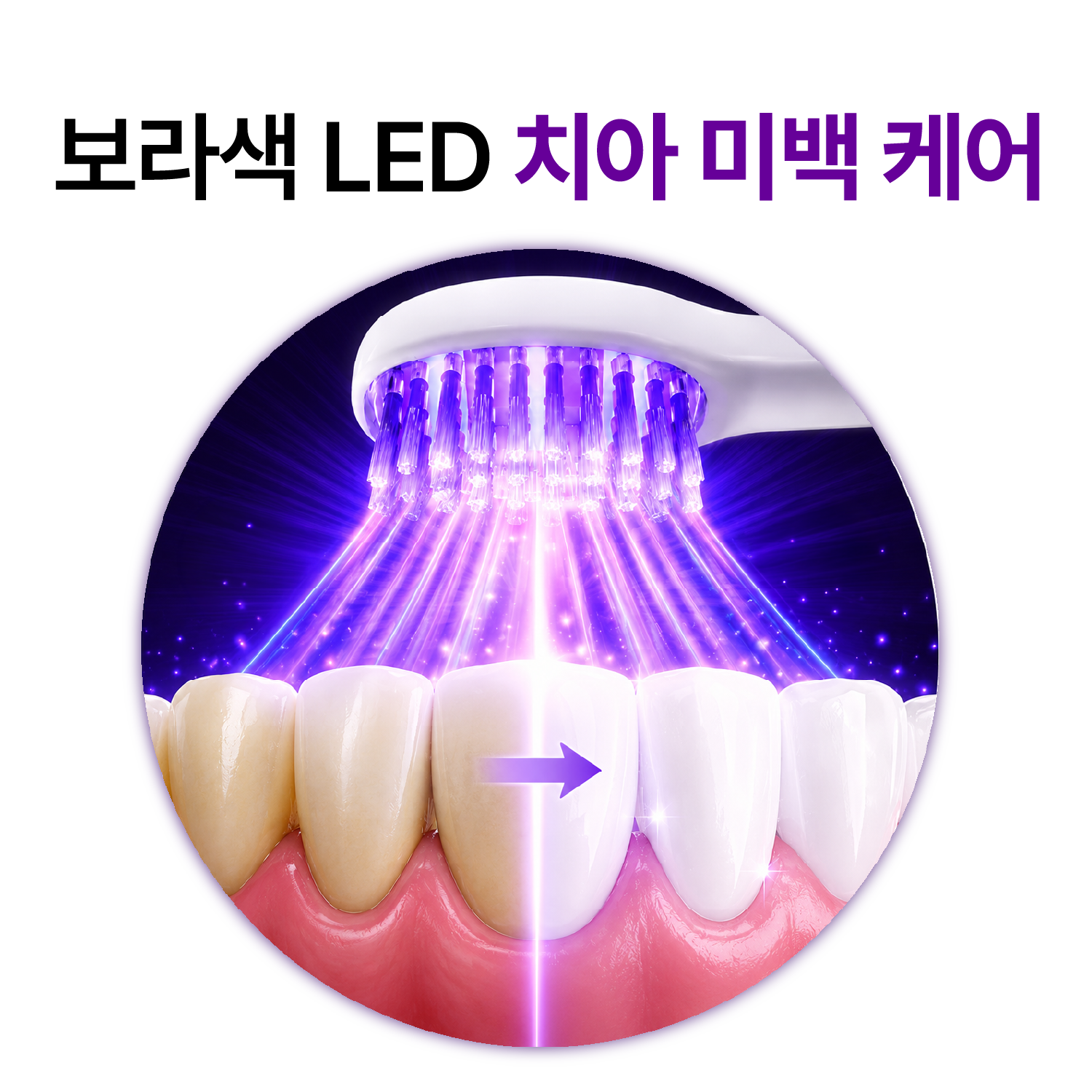 실제 치과 미백 시스템 채택 / 구강탄탄 루미화이트 미백 전동칫솔 특허 보라색 LED 광섬유 칫솔모 잇몸케어 스케일링 - 상세 이미지 5