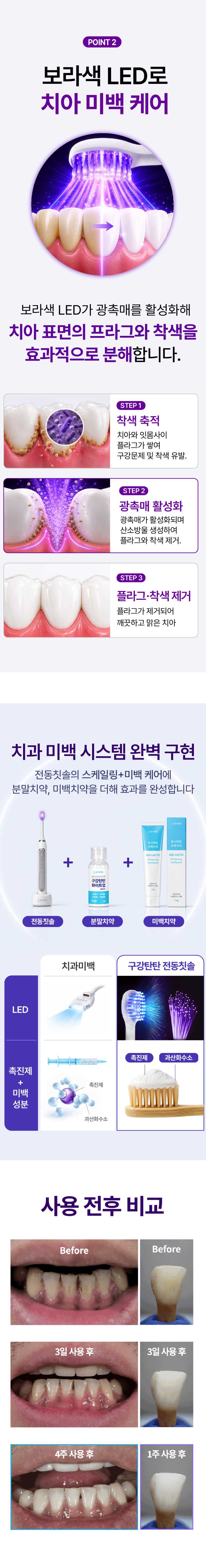 실제 치과 미백 시스템 채택 / 구강탄탄 루미화이트 미백 전동칫솔 특허 보라색 LED 광섬유 칫솔모 잇몸케어 스케일링 판매처 상세 정보 이미지 3