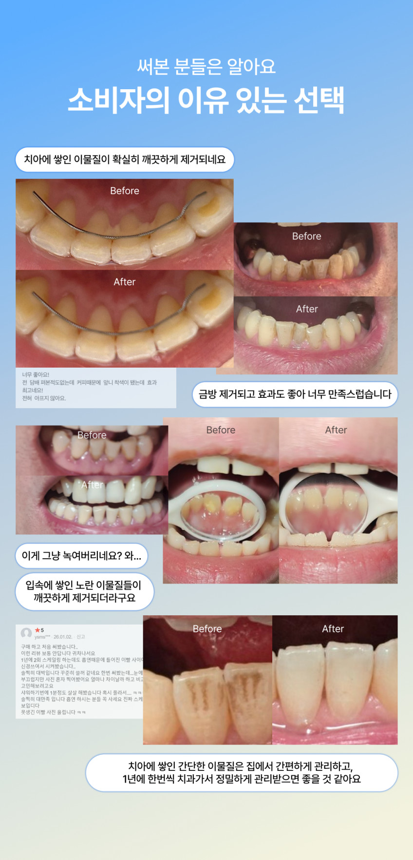 원웨이 프로 치아관리기 구강세정기 셀프 구강청결기 입냄새 제거 V4 판매처 상세 정보 이미지 2