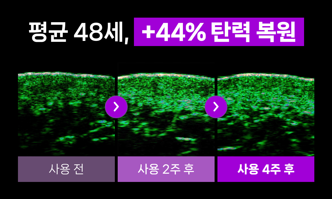 SHAL샬 8시간 수면 마스크팩 얼굴+목 듀얼 리프팅 케어 - 상세 이미지 4