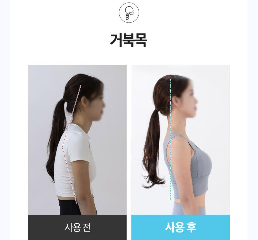 간편 장요근 마사지 단단한 장요근 폼롤러 복부 장요근 스트레칭 - 상세 이미지 5