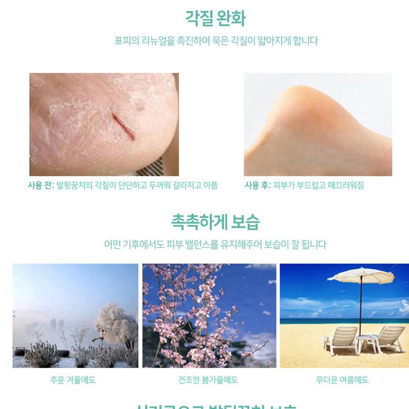 발꿈치갈라짐 실리콘발보습 뒷금치갈라짐 패드 이미지 6