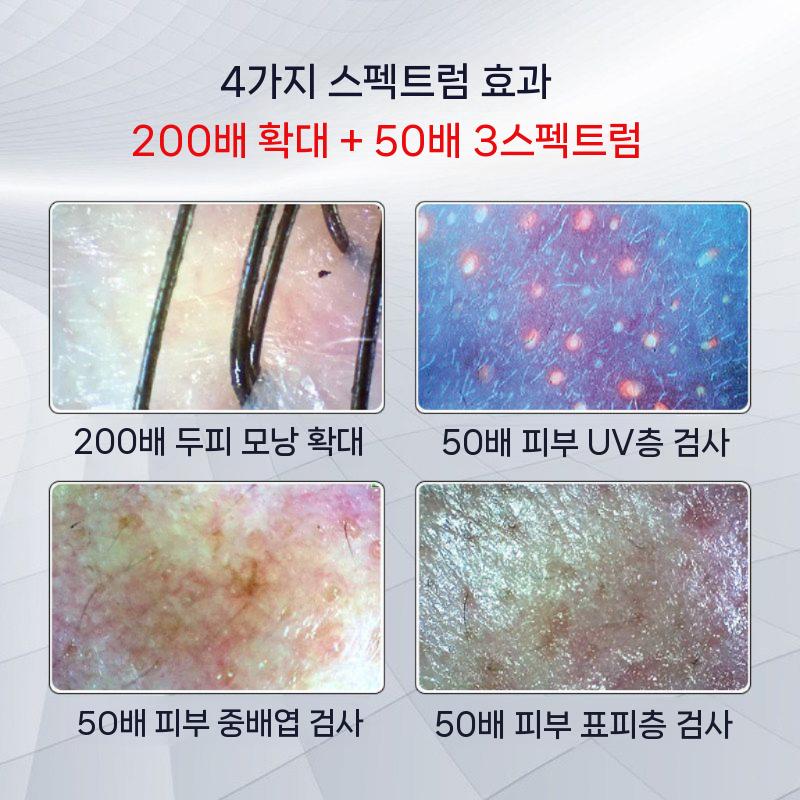 두피진단기 현미경 모니터 두피 두피현미경 두피카메라 - 상세 이미지 5