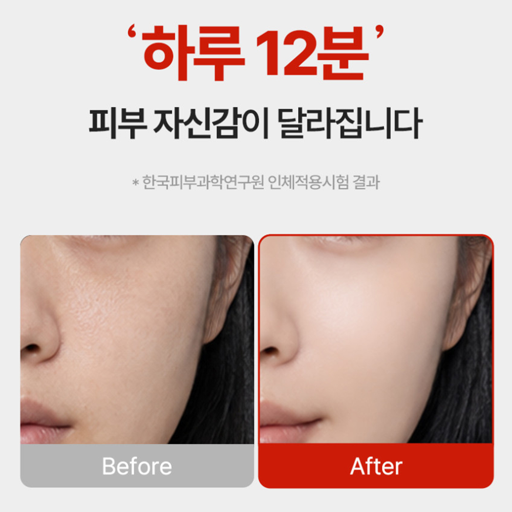 리앤밤 스피듀얼샷 디바이스 물방울 초음파 기기 얼굴 마사지기 홈케어 디바이스 - 상세 이미지 4