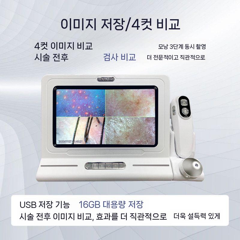 두피진단기 현미경 모니터 두피 두피현미경 두피카메라 - 상세 이미지 4