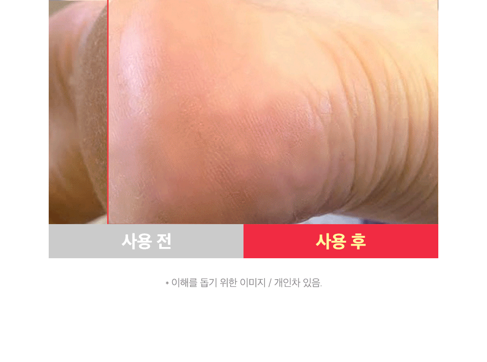 sungboon editor shea butter foot care