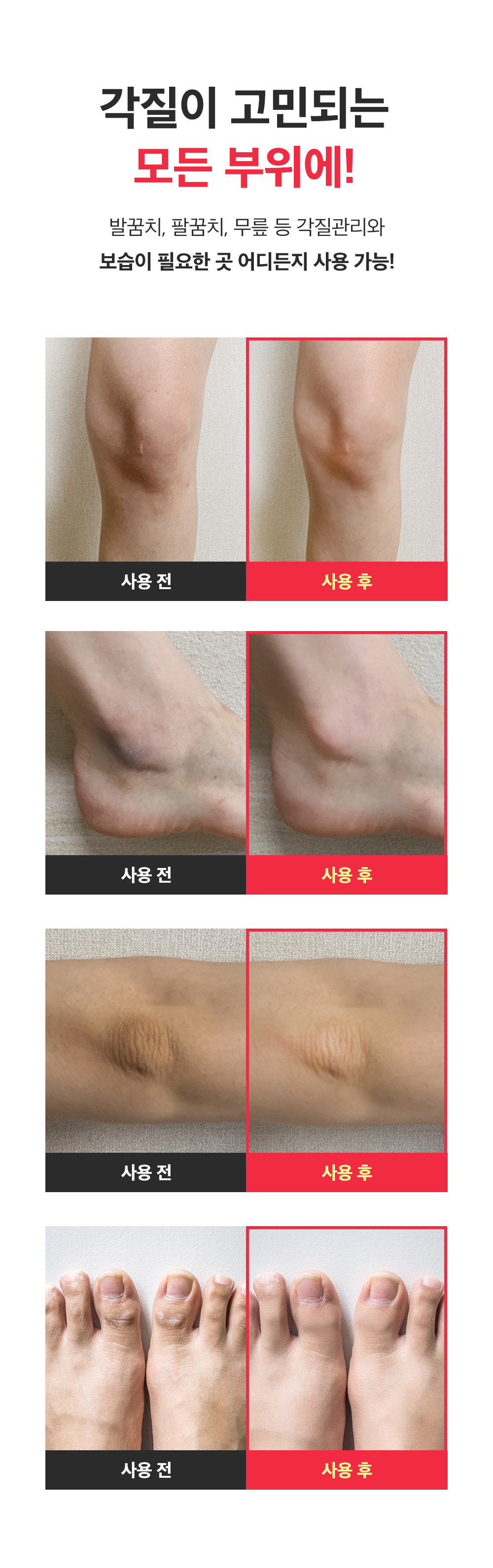 sungboon editor shea butter foot care