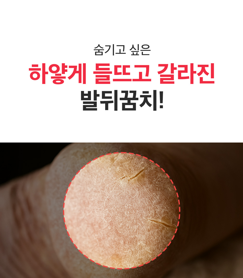 sungboon editor shea butter foot care