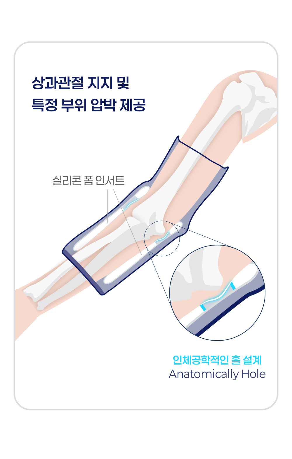 실리스탭_에피_상세_(3).jpg (848×1335)