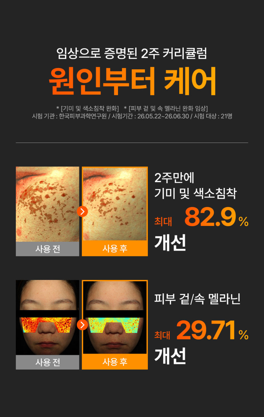 멜라블러 기미 앰플 30ml, 최저가딜 OPEN 판매처 상세 정보 이미지 2