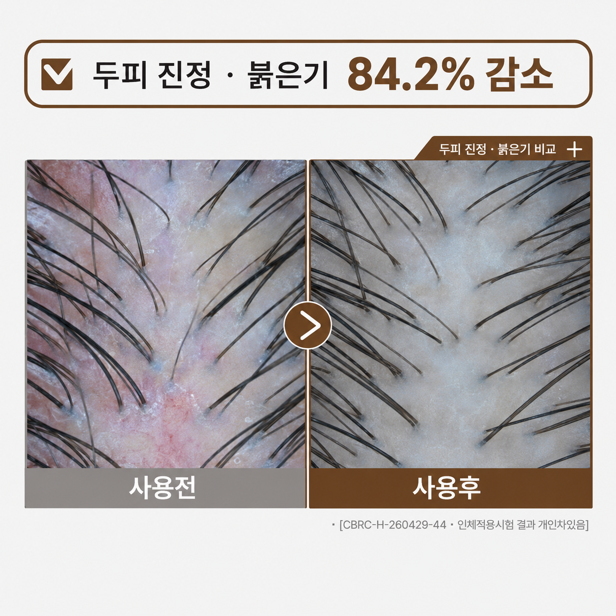 동의모감 창포 모근비책 두피 토닉 가려움 개선 토너 100ml, 1개 - 상세 이미지 3