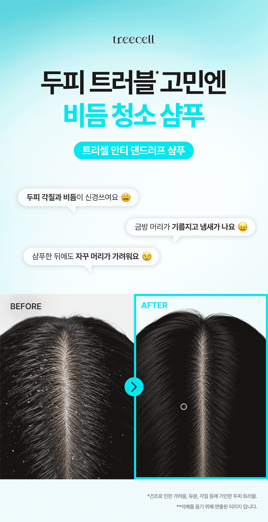 TREECELL Anti Dandruff Shampoo 120ml - description 1