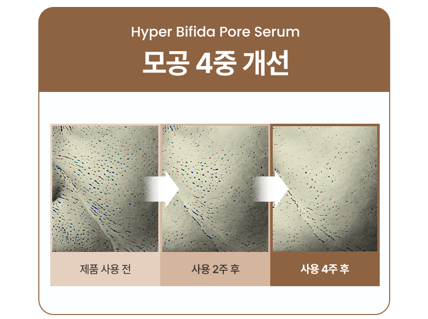 온살 하이퍼 비피다 모공 세럼 30ml 나이아신아마이드 히알루론산 상세 이미지 5
