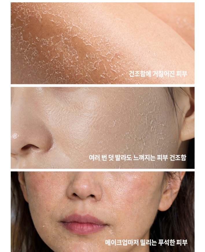 밀로차 콩 판테놀 EGF 악건성 수부지 속보습 수분 장벽 순한 크림 150ml 3개 세트 - 상세 이미지 4