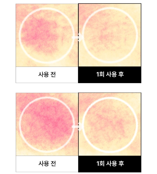 밀로차 콩 알란토인 세라마이드 병풀 히알루론산 보습 진정 세럼 210ml 3개 세트 - 상세 이미지 3