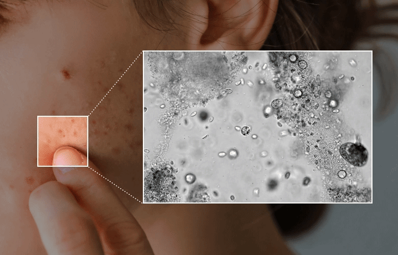 sérum spray totarol meditherapy k-beauty