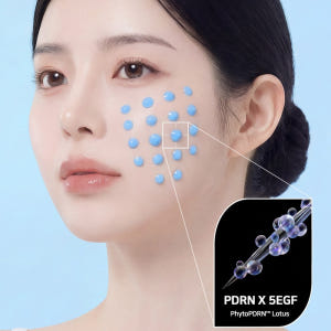 단 1회 사용 후 모공 면적 깊이 개선 닥터겐첼 블루 스피큘 니들 부스터... 솔직 후기 | 피부 타입별 분석 - 상품 이미지 3
