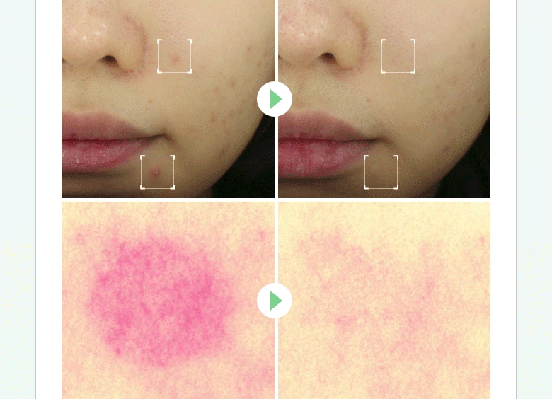 sérum spray totarol meditherapy k-beauty