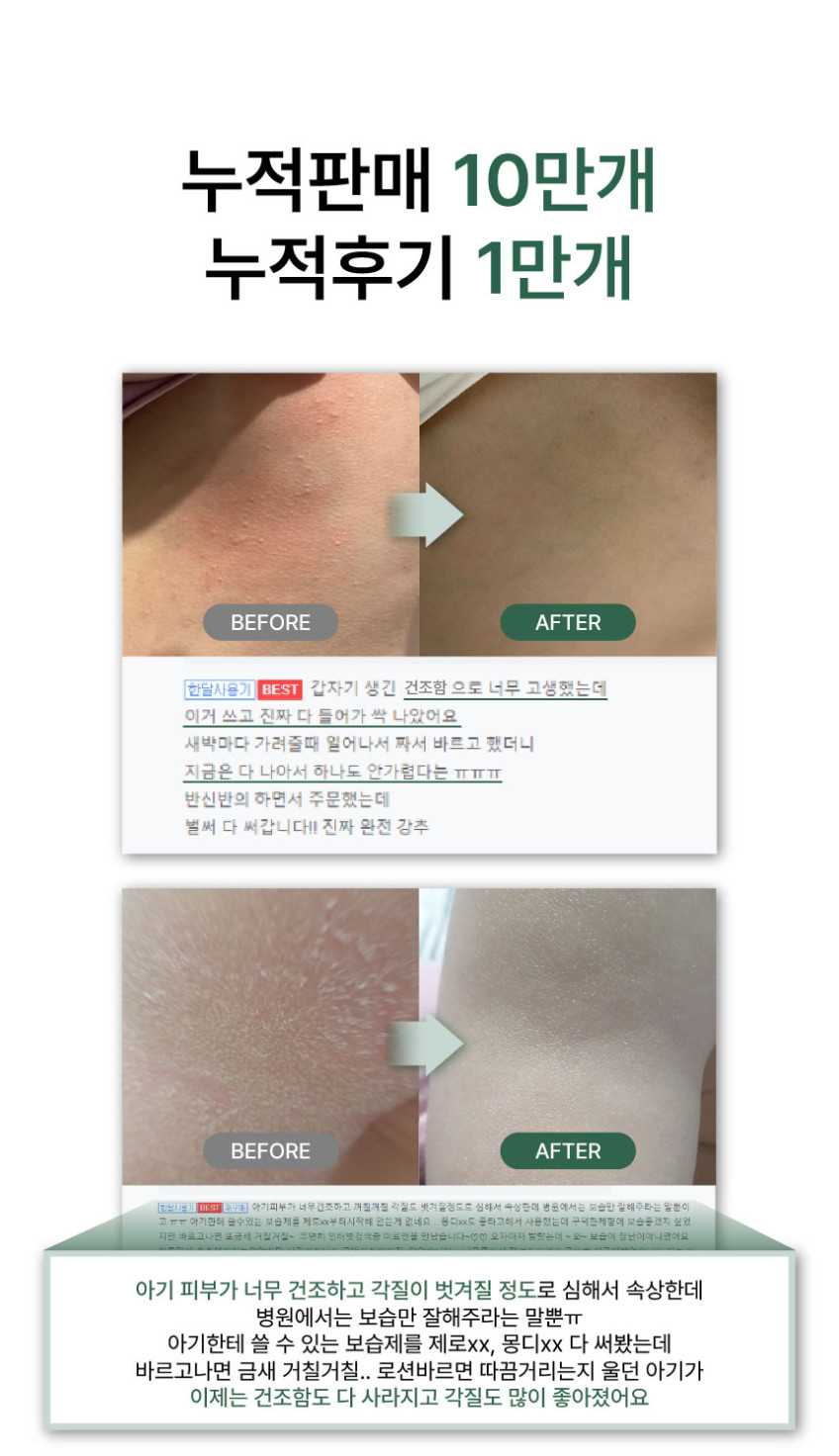 미르엔 시카 바디로션 3+1 판매처 상세 정보 이미지 1