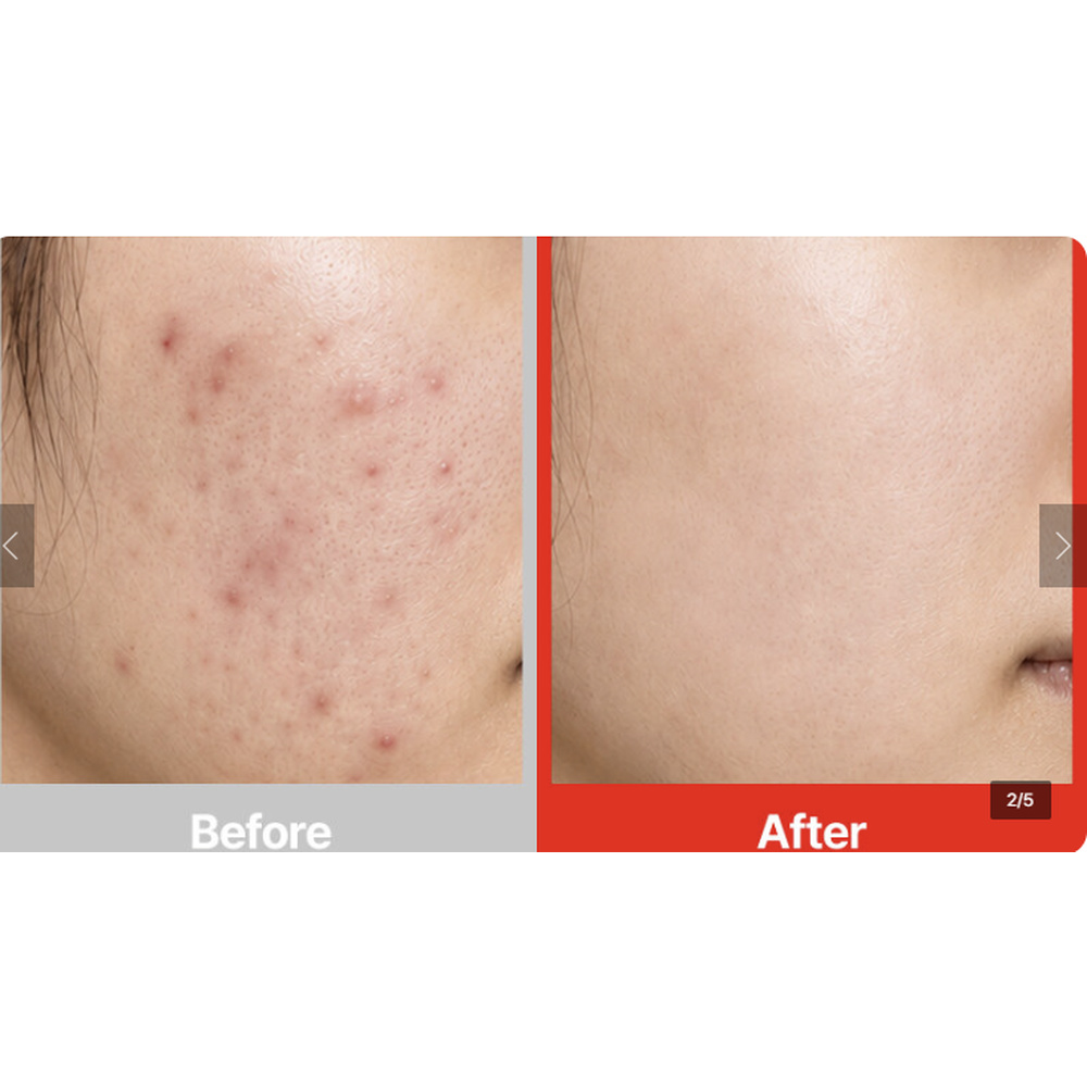 알엔아이오 퓨리톡 블랙헤드 앤 비포토너 25ml 모공 피지케어 트러블케어 - 상세 이미지 3