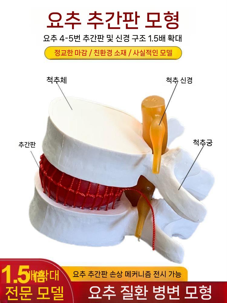 척추 요추 모형 허리 병원 정형외과 교구 모양 화이트 - 상세 이미지 3