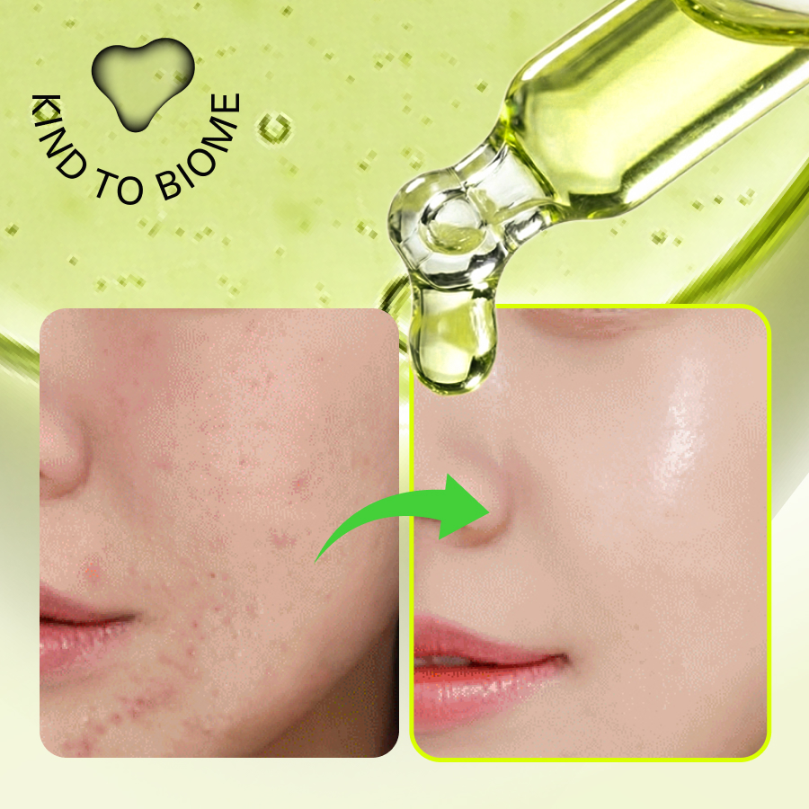 [1+1/도착보장] 에필로우 아티초크 시카 진정 앰플 / 저자극 흔적케어 장벽개선 세럼 50ml, 2개 - 상세 이미지 4
