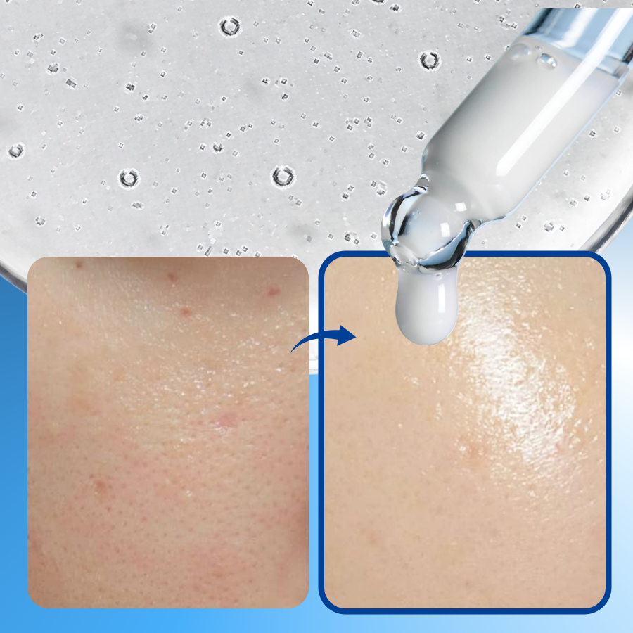 [도착보장] 에필로우 부활초 10중 히알루론산 펩타이드 앰플 / 속수분 탄력 세럼 50ml, 1개 - 상세 이미지 4