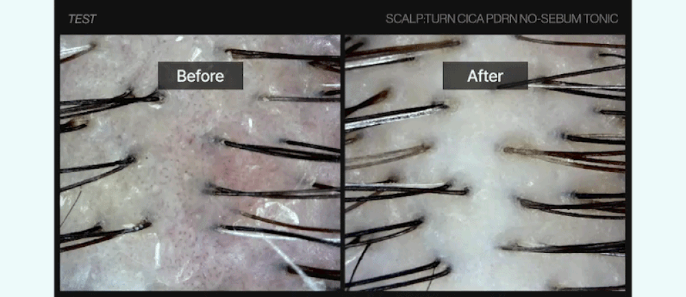 LILYEVE Scalpturn No-Sebum Cooling Tonic - description 25