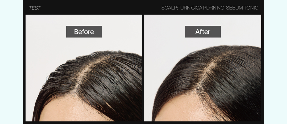 LILYEVE Scalpturn No-Sebum Cooling Tonic - description 17