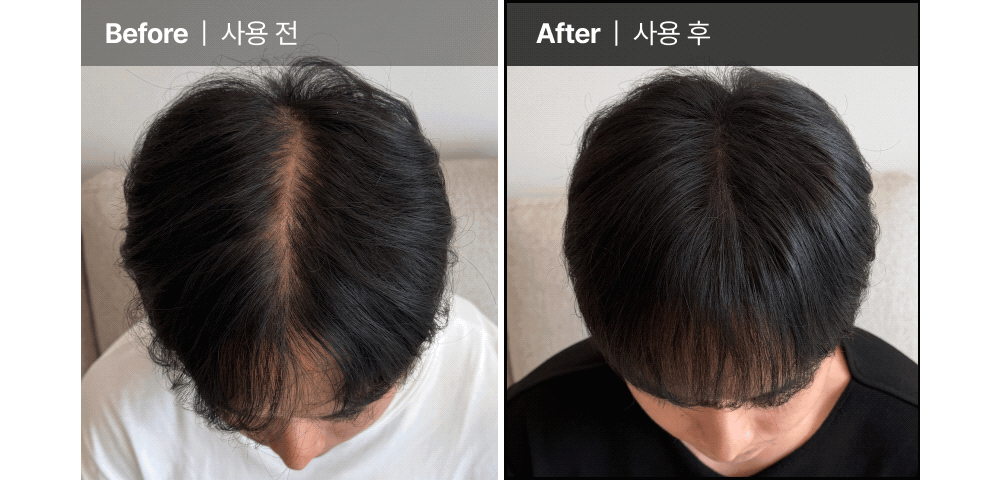 LILYEVE Growturn Caffeine Black Shampoo - description 9