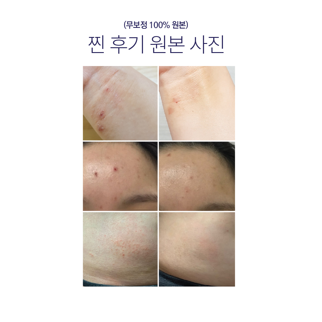 [푸딩수딩아토3개] 가려움 트러블 진정 장벽 아토크림 - 상세 이미지 4