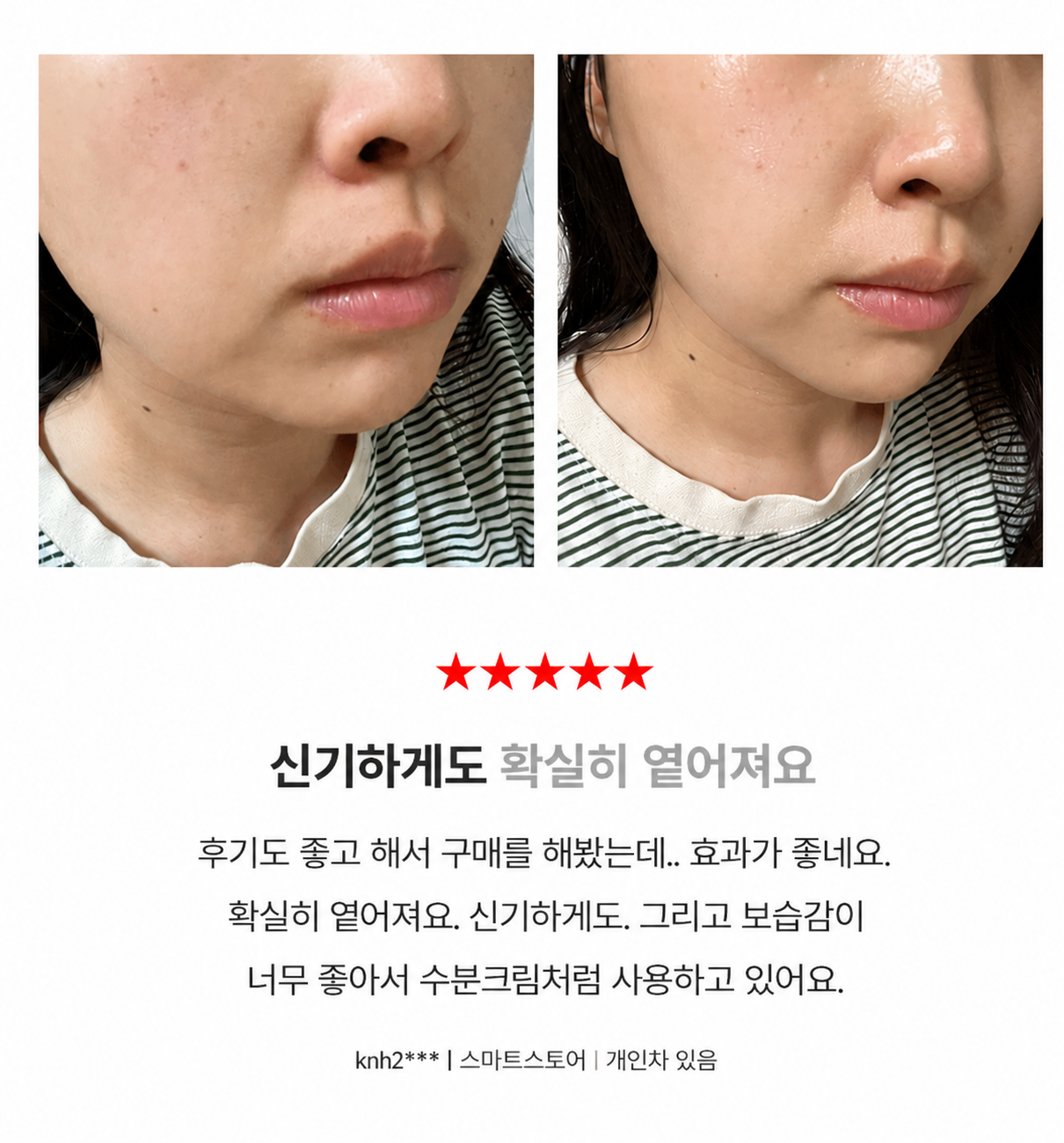 기미원 크림 기미 잡티 착색 연고 멜라논 멜라토닝 크림 - 상세 이미지 4