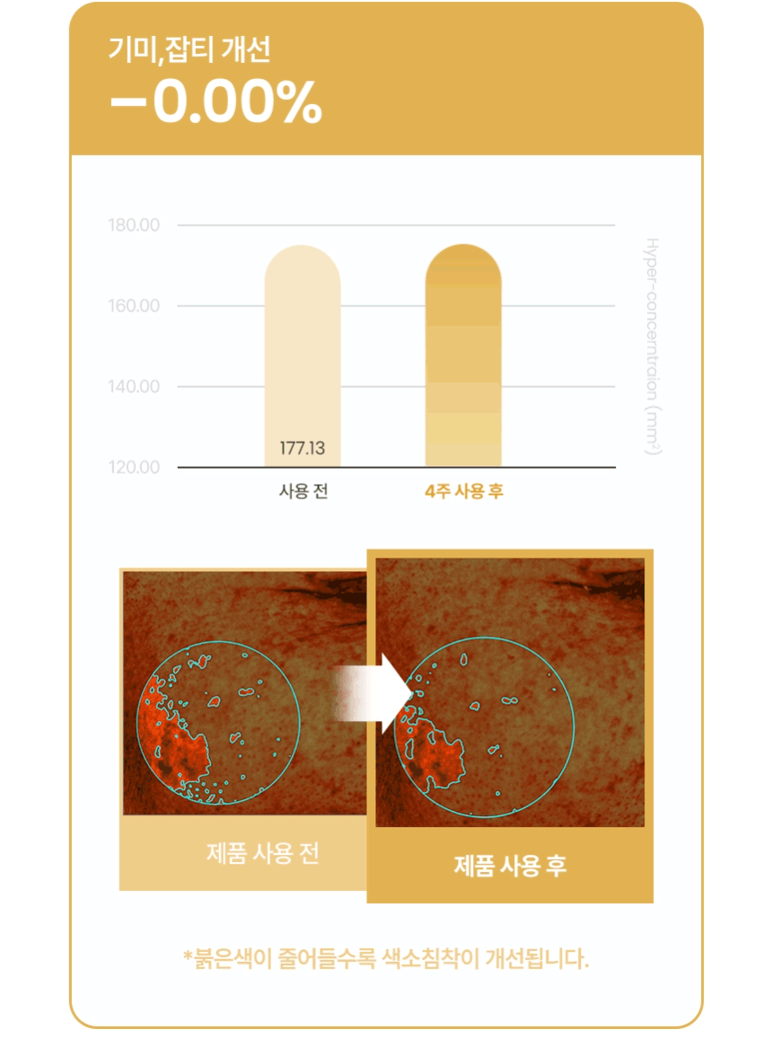 온살 하이퍼 트라넥 흔적 세럼 30ml 트라넥사믹애씨드 나이아신아마이드 상세 이미지 3