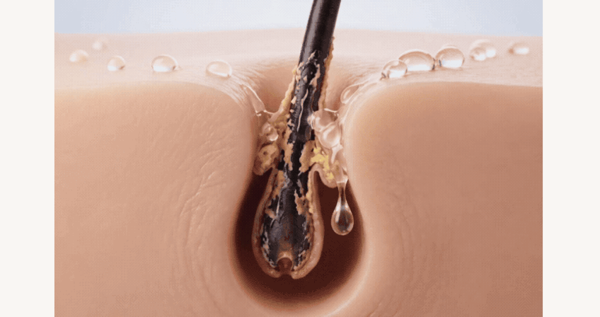 두피 스케일러 안티에이징 리페어오일, 카피로르 아쎄 28ml 두피 영양 탄력 리프팅 안티에이징 에센스 판매처 상세 정보 이미지 2