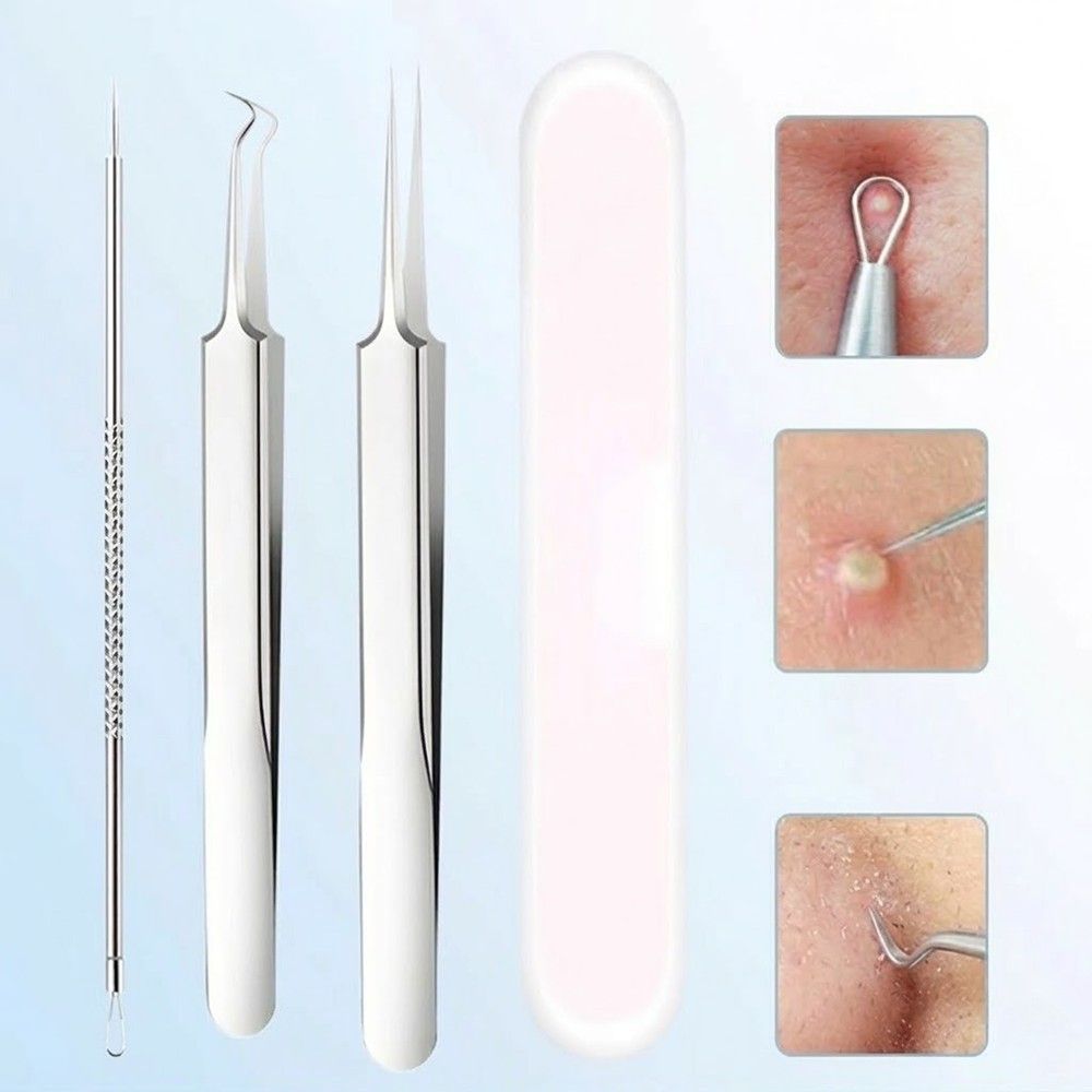 (3P) 피지 제거 압출 압출기 블랙헤드 비립종 바늘 짜는 도구 얼굴 눈 코 핀셋 집게 족집게 - 상품 이미지