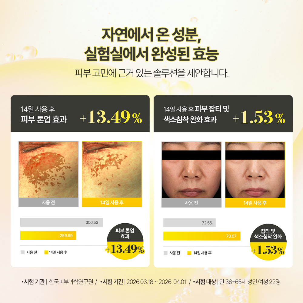 비타C 나이아신아마이드 5% 버블샷 브라이트닝/미백 앰플 1개입, 1개 - 상세 이미지 3
